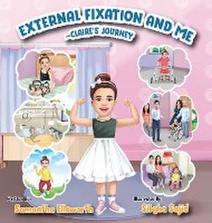 External Fixation and Me de Samantha Ellsworth