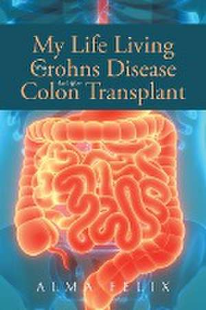 My Life Living With Crohns Disease And After Colon Transplant Surgery de Alma Felix