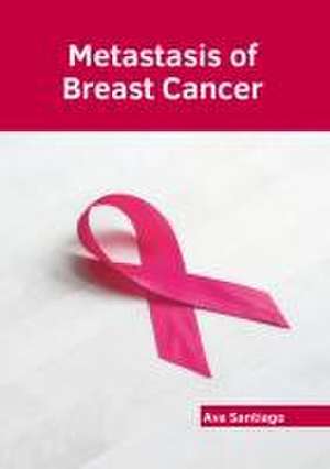 Metastasis of Breast Cancer de Ava Santiago