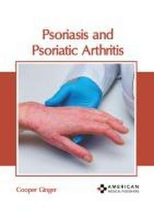 Psoriasis and Psoriatic Arthritis de Cooper Ginger