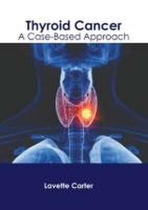 Thyroid Cancer: A Case-Based Approach de Lavette Carter