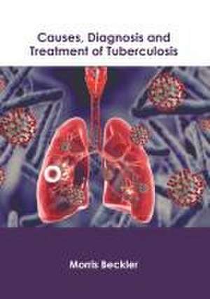 Causes, Diagnosis and Treatment of Tuberculosis de Morris Beckler