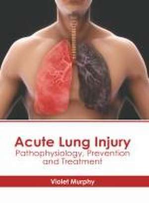 Acute Lung Injury: Pathophysiology, Prevention and Treatment de Violet Murphy