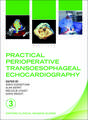 Practical Perioperative Transoesophageal Echocardiography