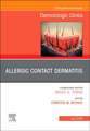 Allergic Contact Dermatitis,An Issue of Dermatologic Clinics