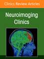 Imaging of the Post Treatment Head and Neck, An Issue of Neuroimaging Clinics of North America