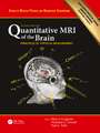 Quantitative MRI of the Brain: Principles of Physical Measurement, Second edition