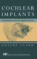 Cochlear Implants: Fundamentals and Applications