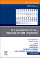 PET Imaging in Central Nervous System Disorders, An Issue of PET Clinics