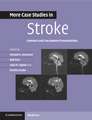 More Case Studies in Stroke: Common and Uncommon Presentations