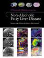 Clinical Dilemmas in Non–Alcoholic Fatty Liver Disease