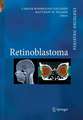 Retinoblastoma