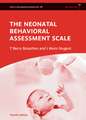 The Neonatal Behavioral Assessment Scale 4e