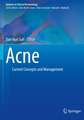 Acne: Current Concepts and Management