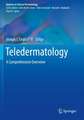 Teledermatology: A Comprehensive Overview