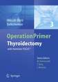 Thyroidectomy: with Harmonic FOCUS®