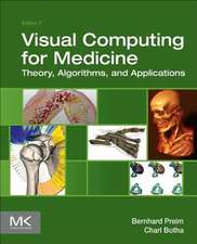 Visual Computing for Medicine: Theory, Algorithms, and Applications