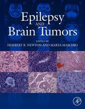 Epilepsy and Brain Tumors