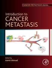 Introduction to Cancer Metastasis