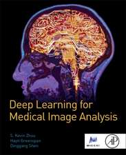 Deep Learning for Medical Image Analysis