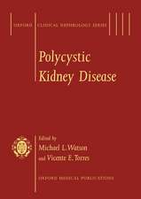 Polycystic Kidney Disease