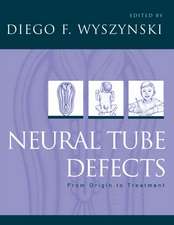 Neural Tube Defects: From origin to treatment