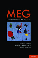 MEG: An Introduction to Methods