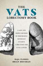 The VATS Lobectomy Book