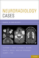 Neuroradiology Cases