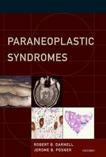 Paraneoplastic Syndromes