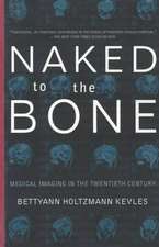 Naked To The Bone: Medical Imaging In The Twentieth Century