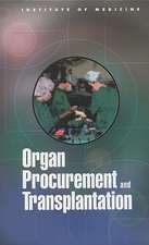 Organ Procurement and Transplantation: Assessing Current Policies and the Potential Impact of the Dhhs Final Rule