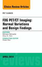 FDG PET/CT Imaging: Normal Variations and Benign Findings - Translation to PET/MRI, An Issue of PET Clinics