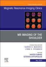 MR Imaging of the Shoulder, An Issue of Magnetic Resonance Imaging Clinics of North America