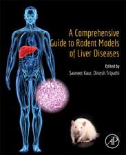 A Comprehensive Guide to Rodent Models of Liver Diseases