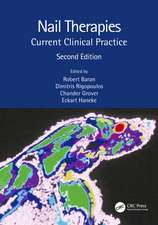 Nail Therapies: Current Clinical Practice