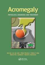 Acromegaly: Pathology, Diagnosis and Treatment