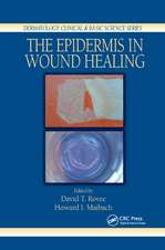 The Epidermis in Wound Healing