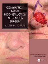 Combination Facial Reconstruction after Mohs Surgery: A Case Based Atlas