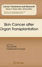 Skin Cancer after Organ Transplantation