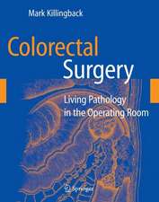 Colorectal Surgery