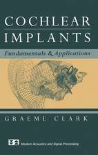 Cochlear Implants: Fundamentals and Applications