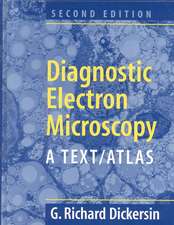 Diagnostic Electron Microscopy: A Text/Atlas