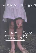 No Bones