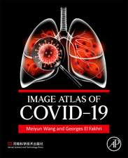 Image Atlas of COVID-19