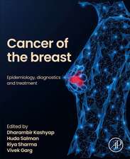 Cancer of the Breast: Epidemiology, Diagnostics and Treatment