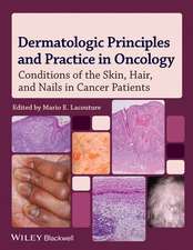 Dermatologic Principles and Practice in Oncology; Conditions of the Skin, Hair, and Nails in Cancer Patients