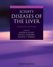 Schiff′s Diseases of the Liver