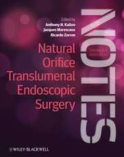 Natural Orifice Translumenal Endoscopic Surgery (NOTES) – Textbook and Video Atlas