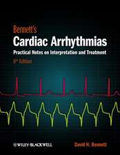 Bennett′s Cardiac Arrhythmias – Practical Notes on Interpretation and Treatment 8e